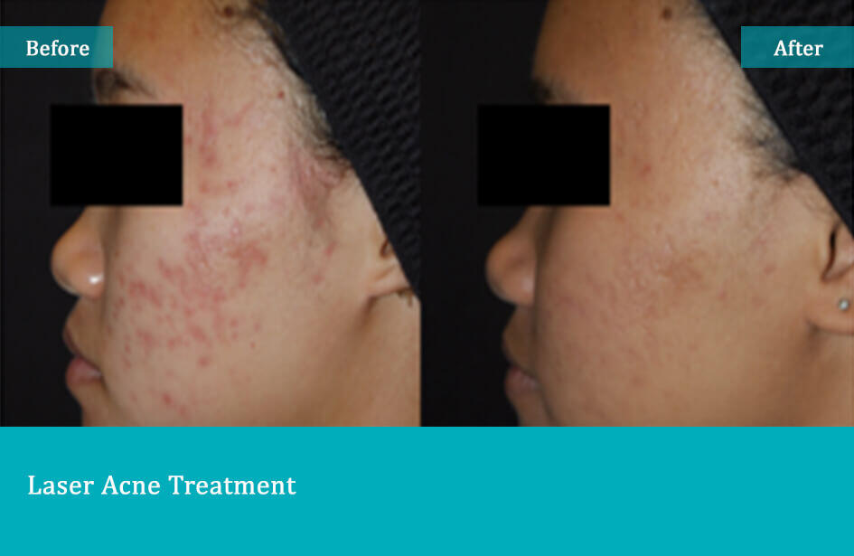before-after-7