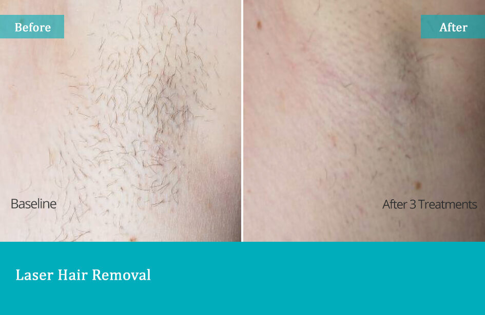 before-after-9