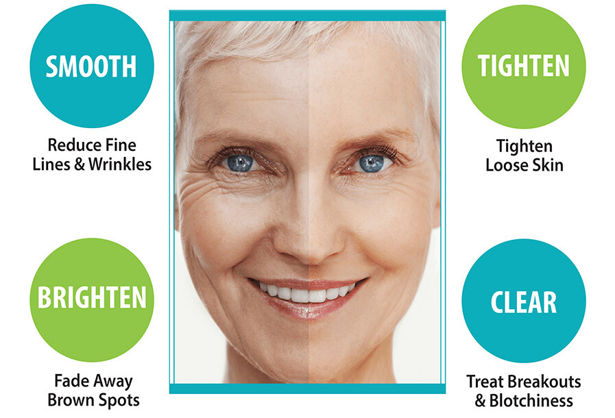 Facial package infographic